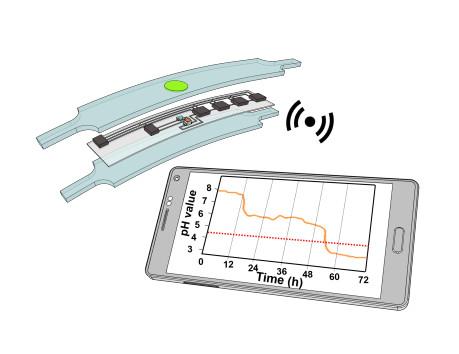 Wireless and Flexible Optoelectronic System for In Situ Monitoring of  Vaginal pH Using a Bioresorbable Fluorescence Sensor